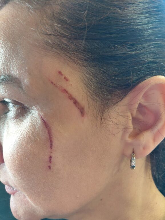 <strong>Hostelería Albacete Unida condena la agresión sufrida por la propietaria de Valkiria ́s Café Bar y exige que no quede impune</strong>